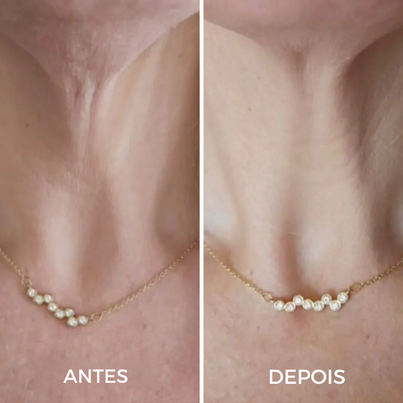 Tighten & Lift Neck Cream - Moika