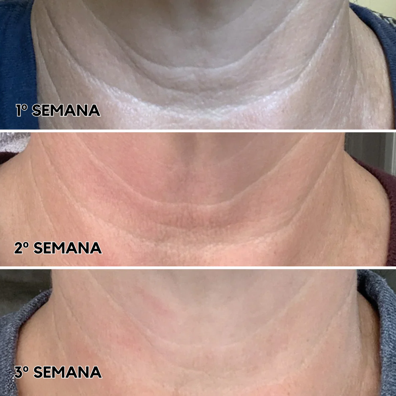 Tighten & Lift Neck Cream - Moika