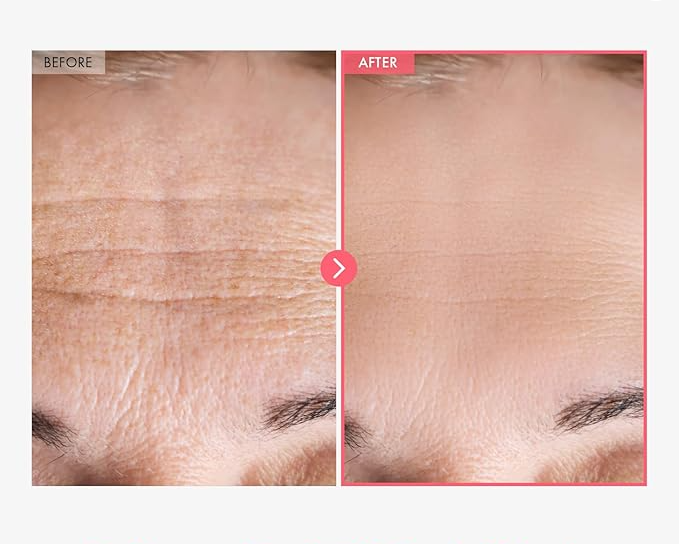 Real Collagen Fit - ByNature